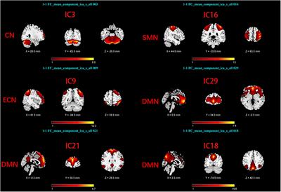 Abnormal intra- and inter-network functional connectivity of brain networks in early-onset Parkinson’s disease and late-onset Parkinson’s disease